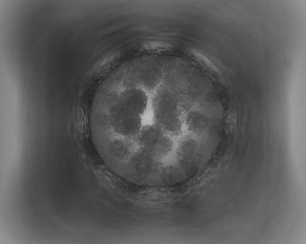 X0000111250917200907021428