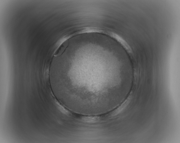X0000111251185200907021425