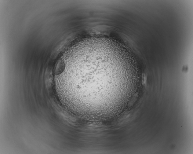 X0000111250915200907091420