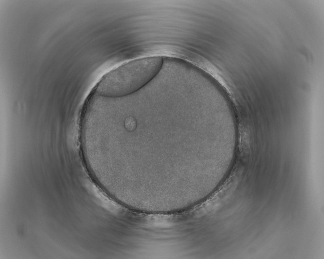 X0000111251116200908131201