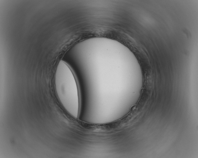 X0000111350750200907100935