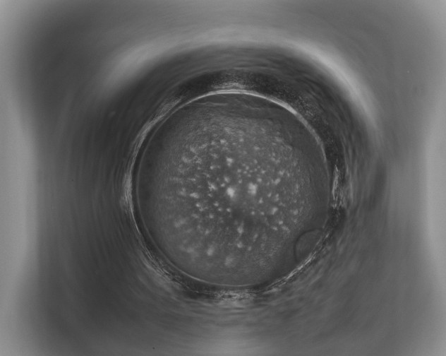 X0000111350099200907101218