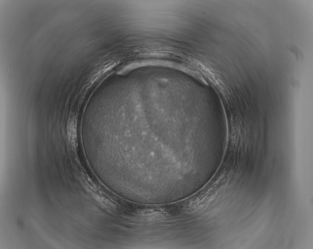 X0000111350386200907171147