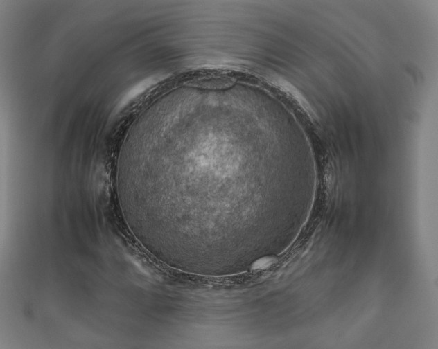 X0000111351064200907171138