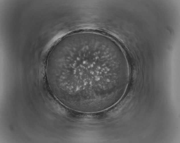 X0000111351359200907171134