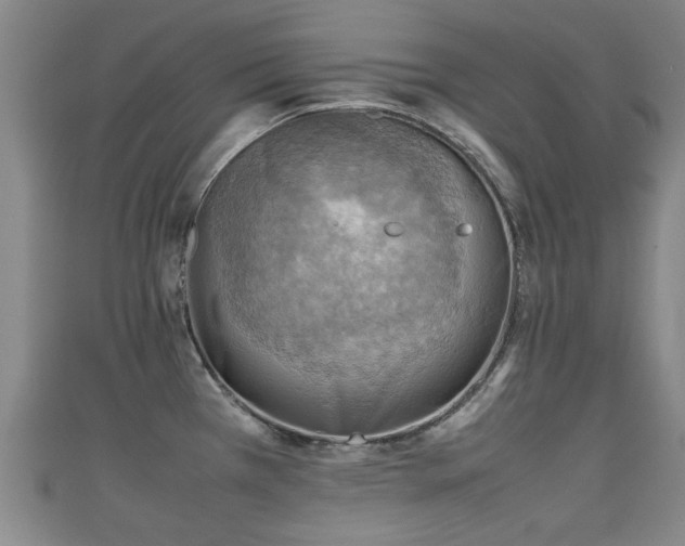 X0000111351385200907171134