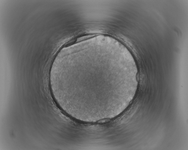 X0000111350385200908071137