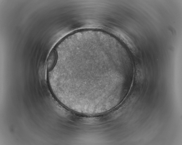 X0000111351276200908071125