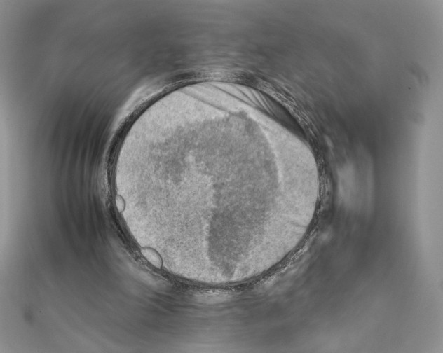 X0000111350198200908211242
