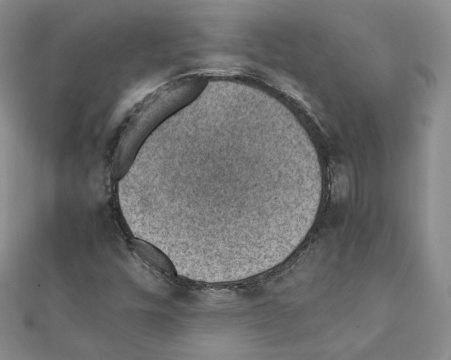 X0000111351448200908211224