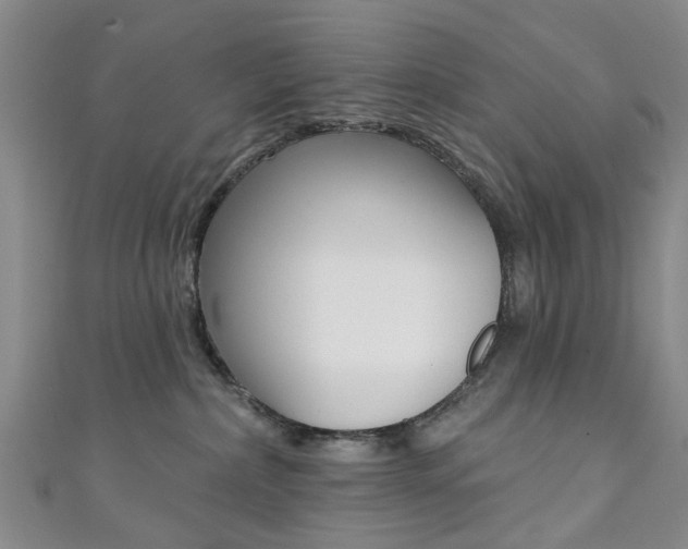 X0000111360236200907101003
