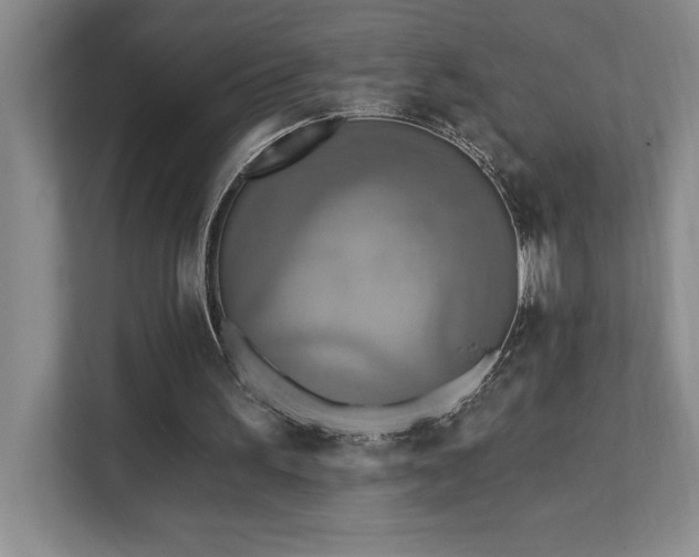 X0000111360195200907101237