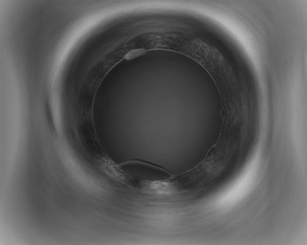 X0000111360239200907101237