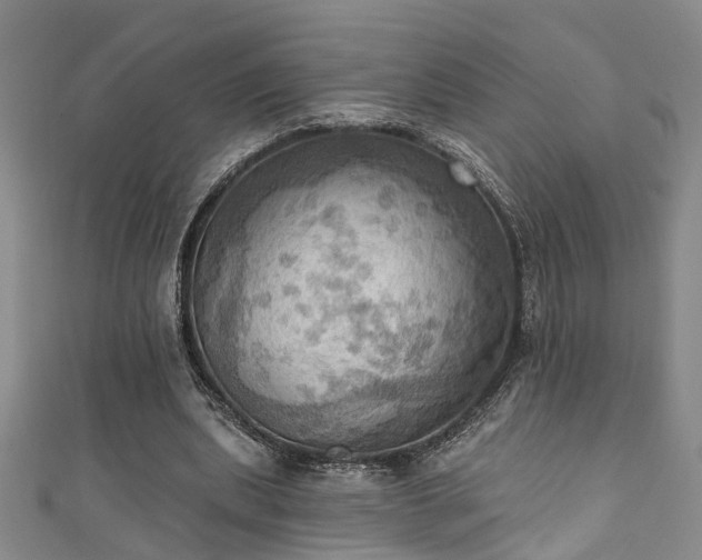 X0000111360439200907171207