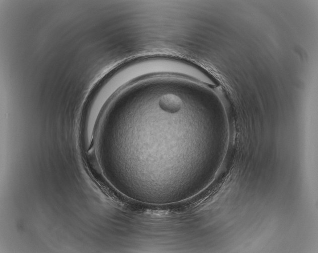 X0000111360440200907171207