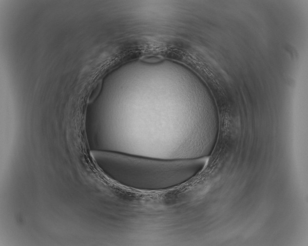 X0000111361153200907171158