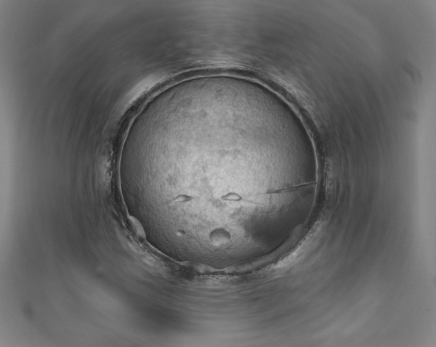 X0000111361163200907171158