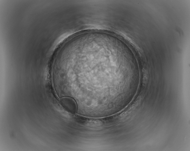 X0000111361215200907171157