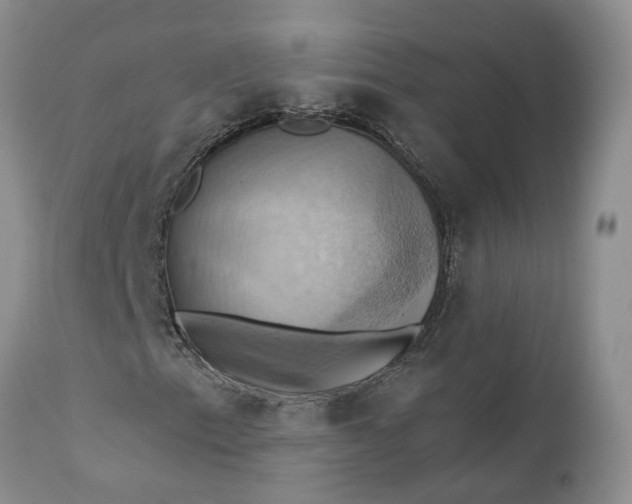 X0000111361153200907241215
