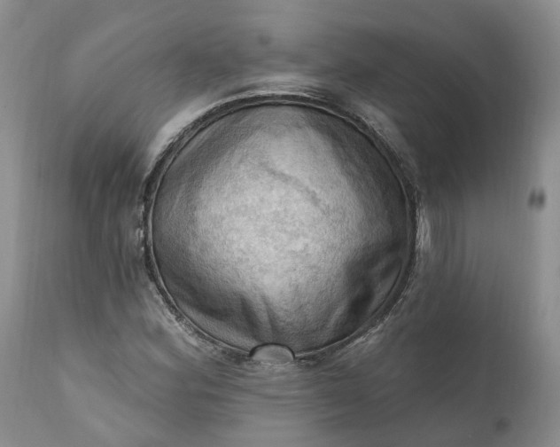 X0000111361164200907241215