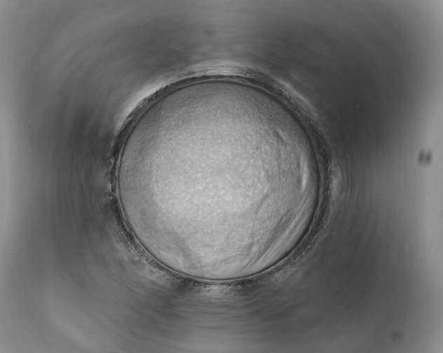X0000111361166200907241215