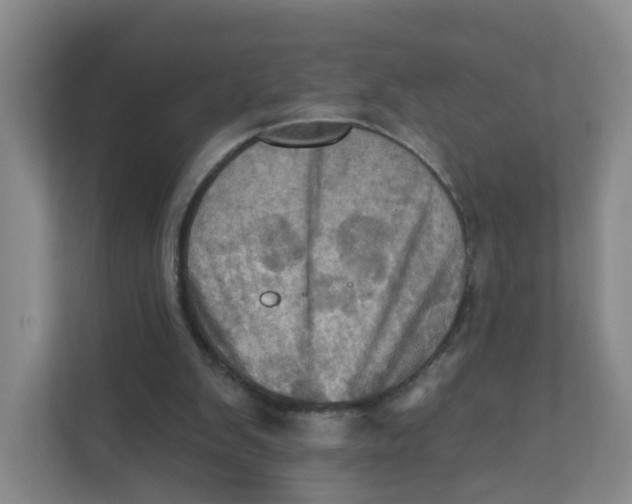 X0000111360103200907311021