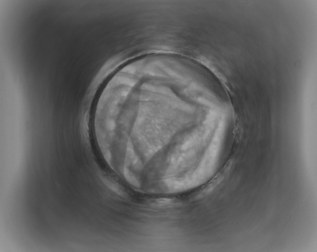 X0000111360151200907311020