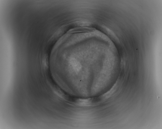 X0000111360170200907311020