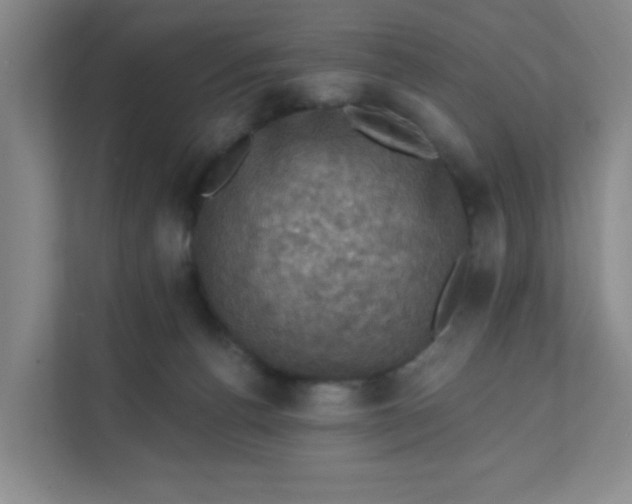 X0000111360176200907311020