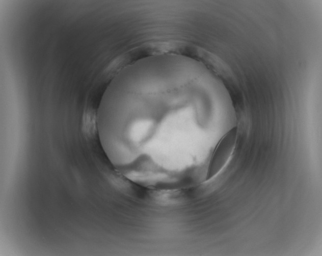 X0000111360191200907311020