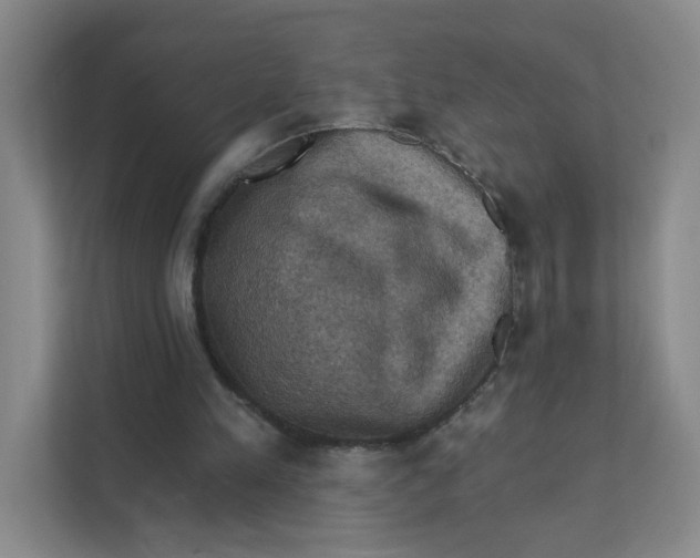 X0000111360197200907311019