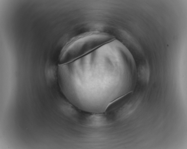 X0000111360280200907311019