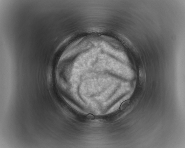 X0000111360396200907311017