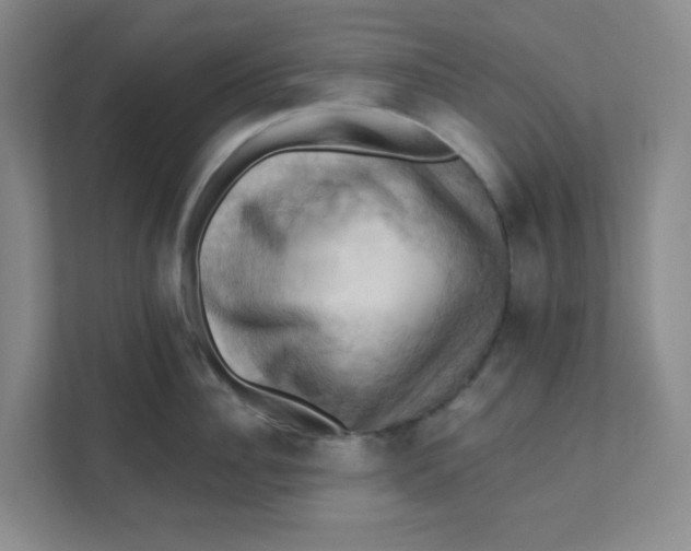 X0000111360956200907311010