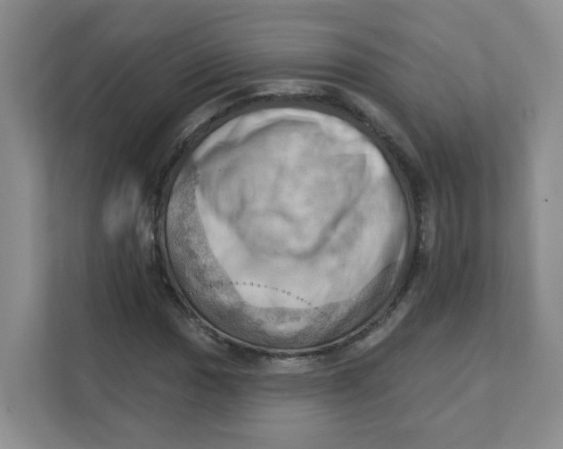 X0000111361017200907311008