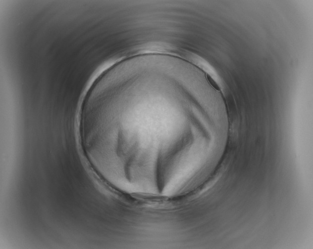 X0000111361146200907311007