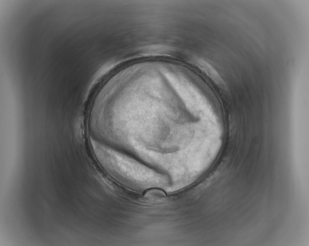 X0000111361164200907311007