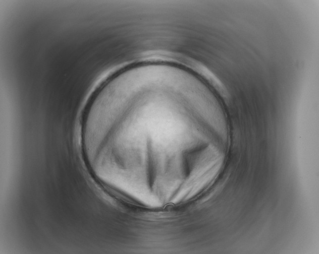 X0000111361376200907311004