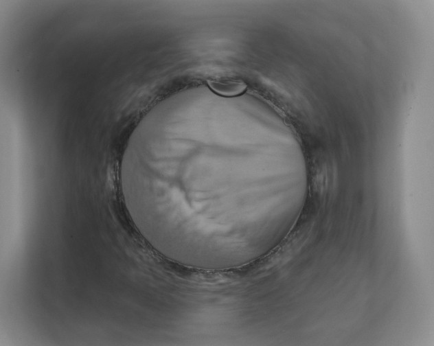 X0000111361397200907311003
