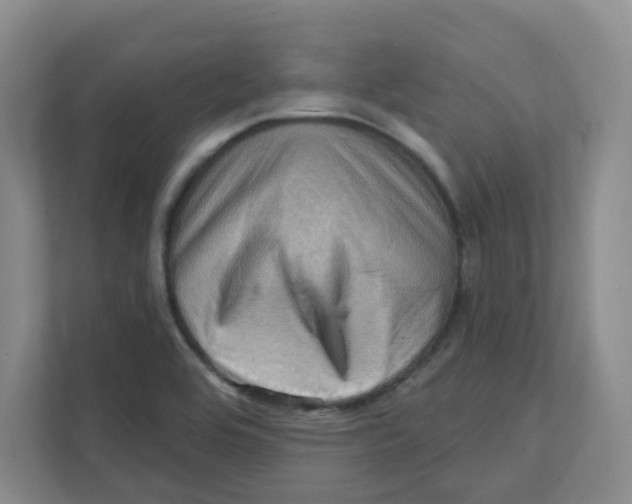 X0000111361464200907311003