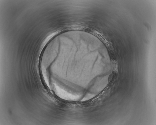 X0000111360147200908071200