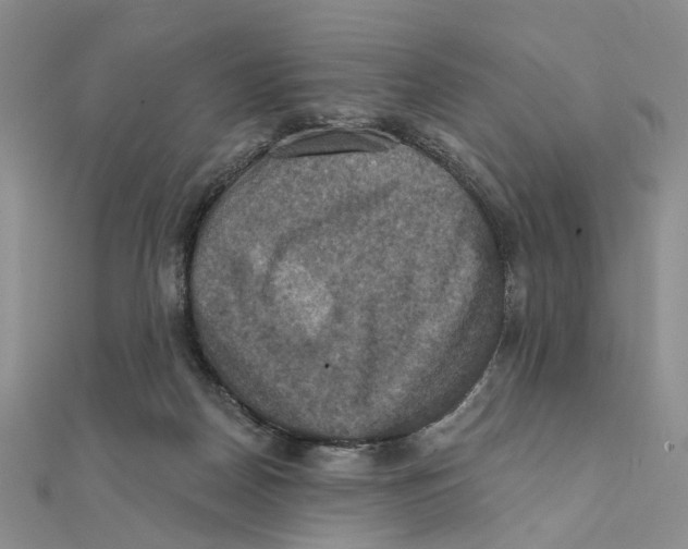 X0000111360170200908071200