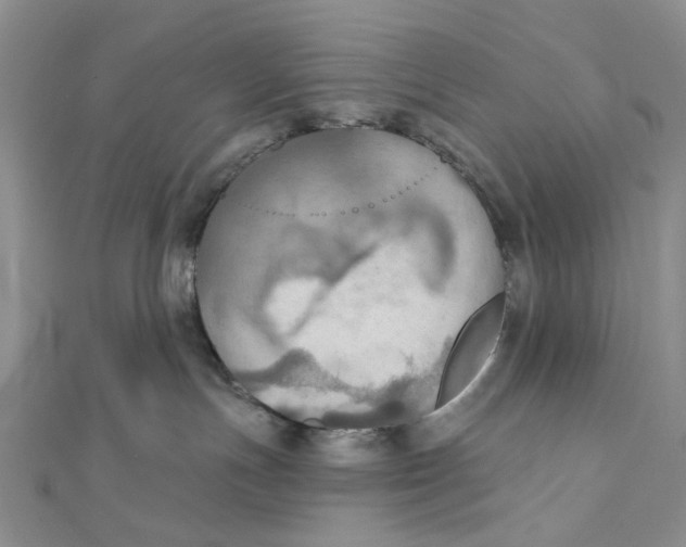 X0000111360191200908071200