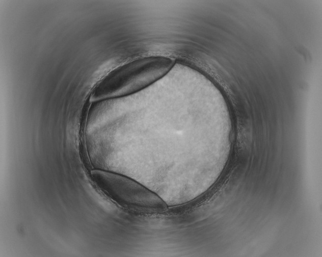 X0000111360530200908071155