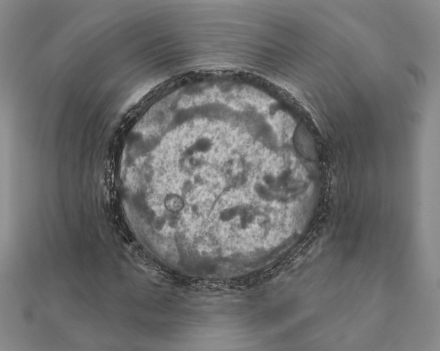 X0000111360871200908071151