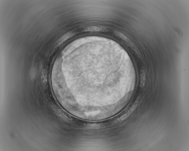 X0000111361017200908071149