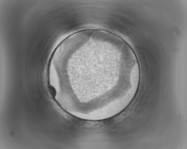 X0000111361056200908071149