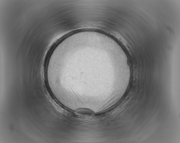 X0000111361072200908071148