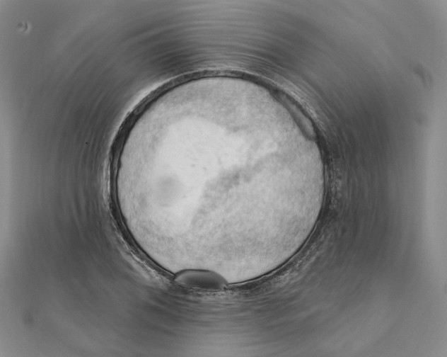 X0000111361076200908071148