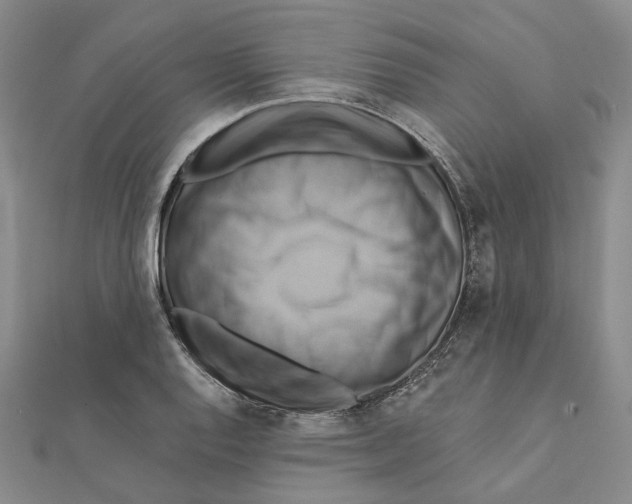 X0000111361128200908071148